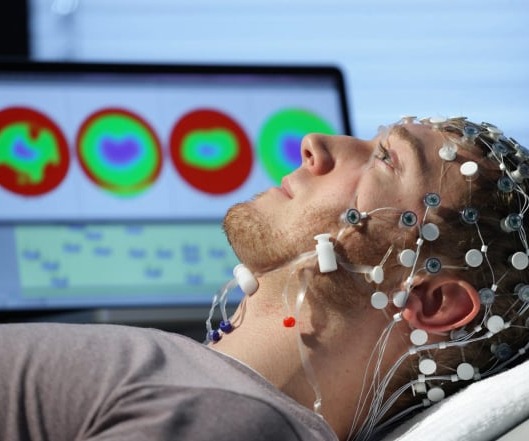 Εγκεφαλογράφημα