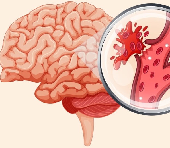 Ανδρικός υπογοναδισμός