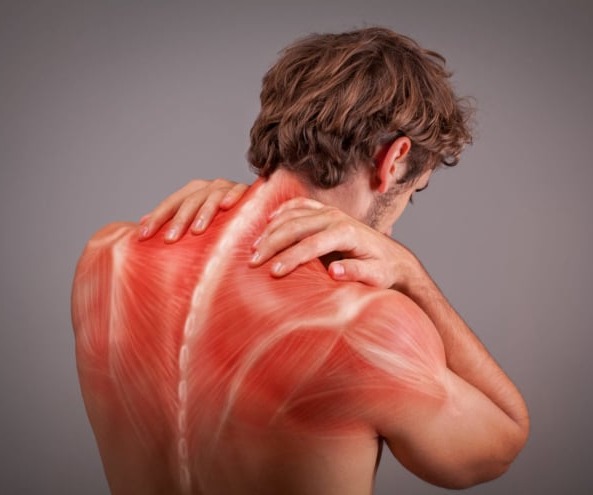 Μυοπάθειες, Μυαλγίες